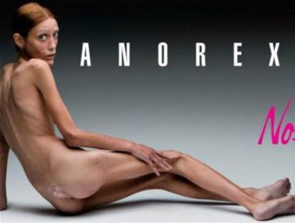 El mensaje en contra de la anorexia de la marca Nolita fue bastante chocante por lo fuerte de sus imágenes.