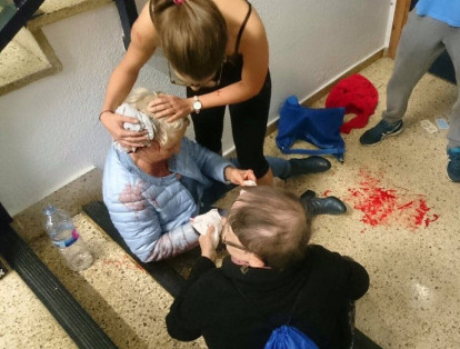 Una mujer atiende a otra, que resultó herida durante choques entre policía e independentistas en Cataluña.