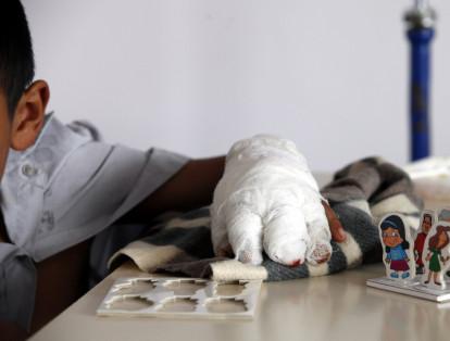 4. Bogotá registró 14 menores lesionados con pólvora, por lo que se amonestaron a 4 adultos responsables y se abrieron 7 PARD.