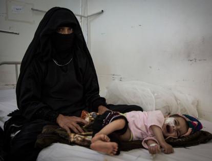 En Yemen, Besam lleva a su hijo de siete meses al centro de salud para un chequeo después de que presentara fiebre alta y vómitos. El niño está desnutrido, pero según el médico, estos casos ocurren muy a menudo: "Las madres dejan de amamantar y reemplazan su leche por una en polvo, pero el agua no está limpia y los niños se enferman"..