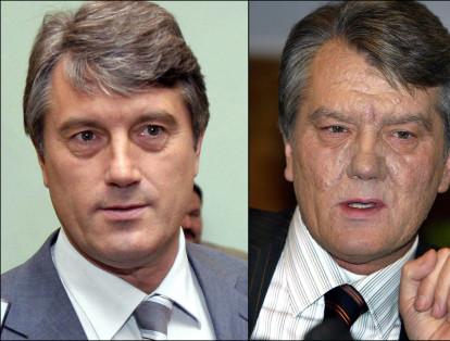Desfigurado con dioxina
En septiembre de 2004, el ucraniano Viktor Yúshchenko, candidato de la oposición y héroe de la Revolución Naranja, cayó gravemente enfermo en plena campaña por la elección presidencial que lo oponía al candidato favorito de Moscú, Viktor Yanukovich. Médicos austriacos identificaron tres meses después un envenenamiento con dioxina. Yúshchenko  ganó los comicios presidenciales en enero de 2005. Pese a los cuidados, su rostro deformado conserva los rastros de la enfermedad.