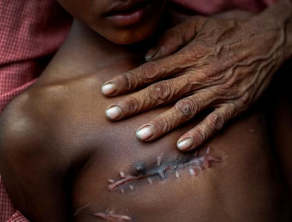 Mohammed Shoaib, de 7 años, recibió un disparo en el pecho antes de cruzar la frontera con Myanmar en agosto.
