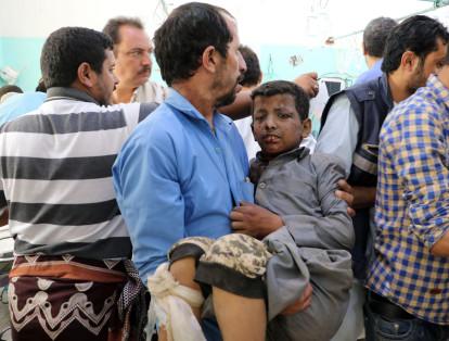 Un hombre lleva en brazos a un niño herido en el ataque a un bus en Saná, capital de Yemen.