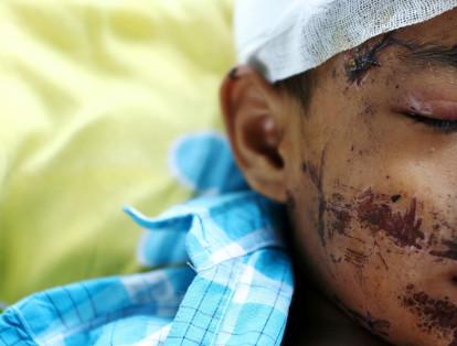Una víctima del terremoto y tsunami que afectaron a Indonesia en octubre. La fotografía fue tomada en un hospital de Palu, una localidad de Indonesia que se ubica en la isla de Célebes.