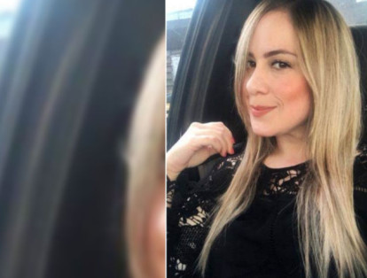 Ana Bolena Carvajal, de 32 años, se sometió a una liposucción el pasado 14 de febrero en Armenia y falleció horas después.