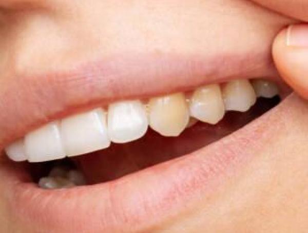 Dientes