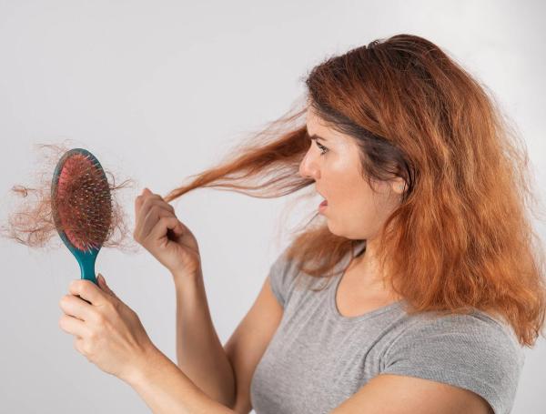 La alopecia afecta a niños, hombres y mujeres.