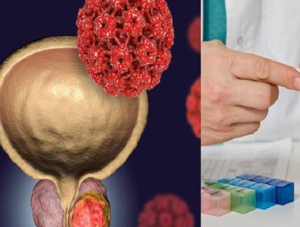Cáncer de próstata