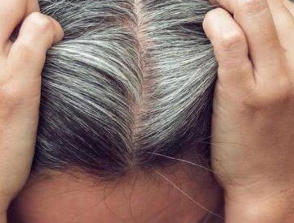 La canicie es la pérdida de pigmentación del cabello