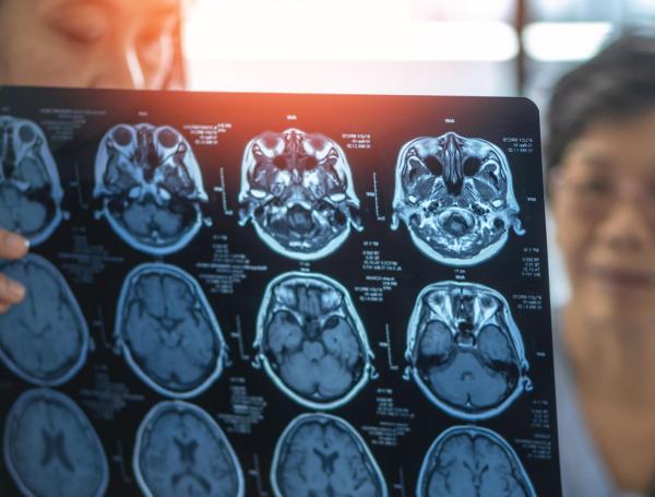 El 'Tomafrán' ayuda a las enfermedades cognitivas