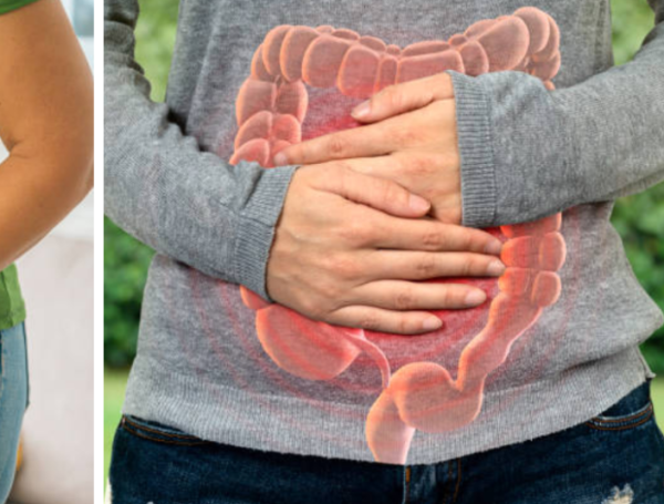 cáncer intestino