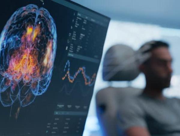 cerebro