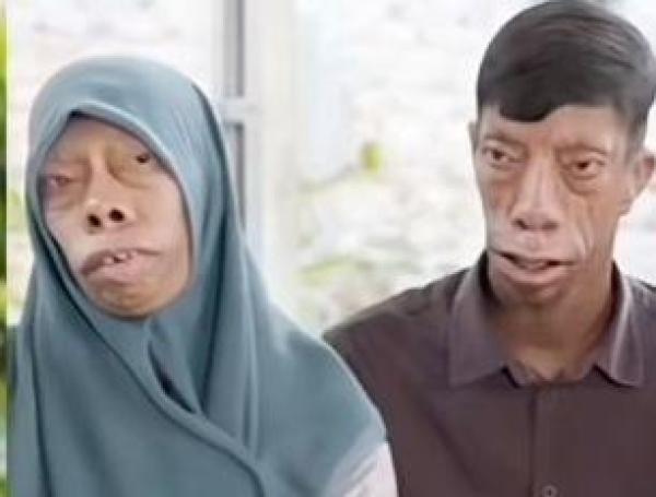 Estos son dos de los miembros que presentan las anomalías faciales heredadas por el padre.