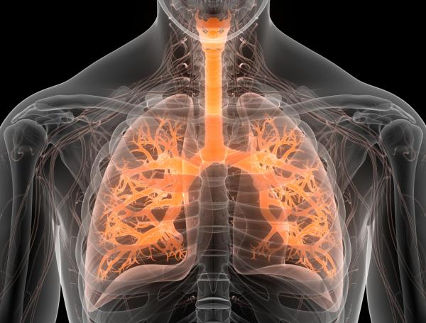 La fibrosis pulmonar es una enfermedad en la que el tejido de los pulmones se cicatriza e impide la respiración.