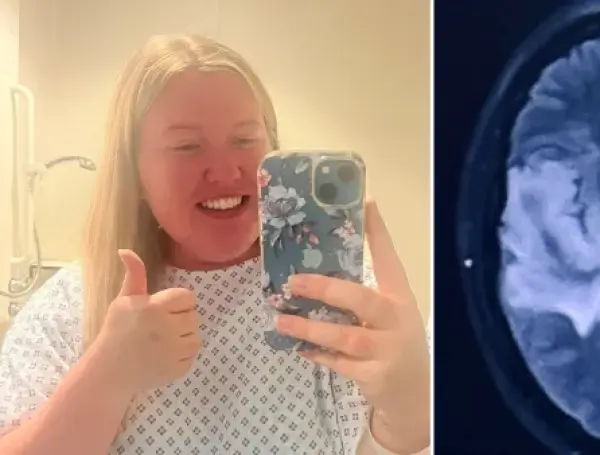Mujer con tumor tipo 3