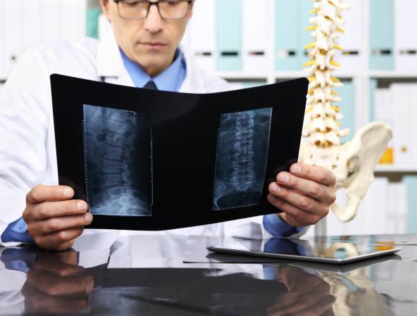 Para que el médico pueda diagnosticar la hernia discal, se debe hacer una radiografía.