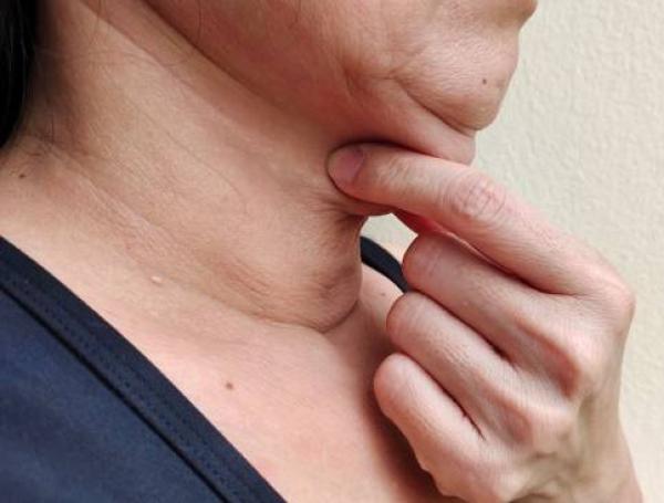El yoga facial puede ayudar con al reducción de la papada, siempre y cuando vaya acompañado de otros buenos hábitos.