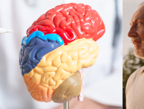 Cerebro