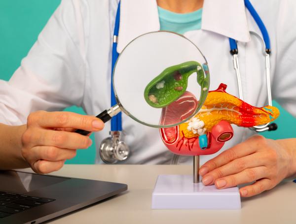 cáncer de vesícula biliar
