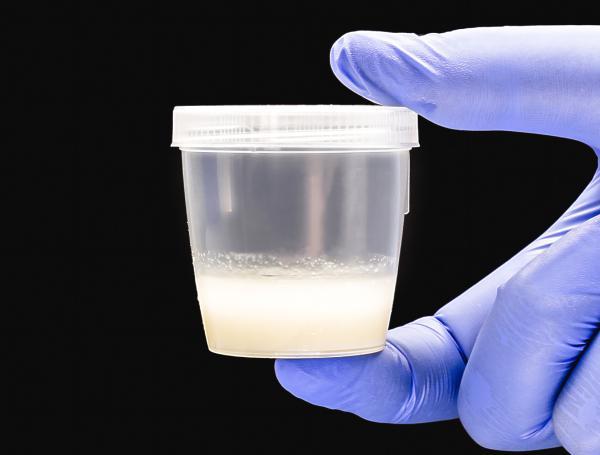 semen