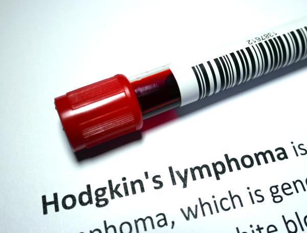 linfoma de Hodgkin