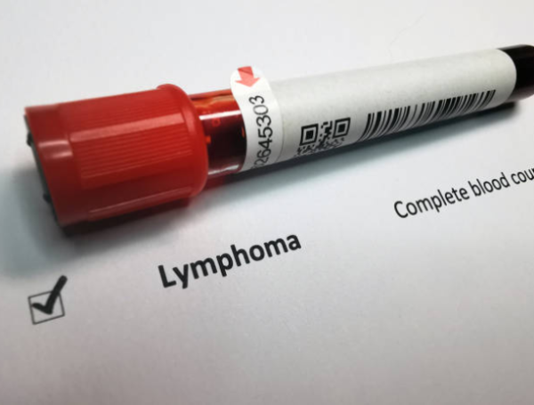 Leucemia