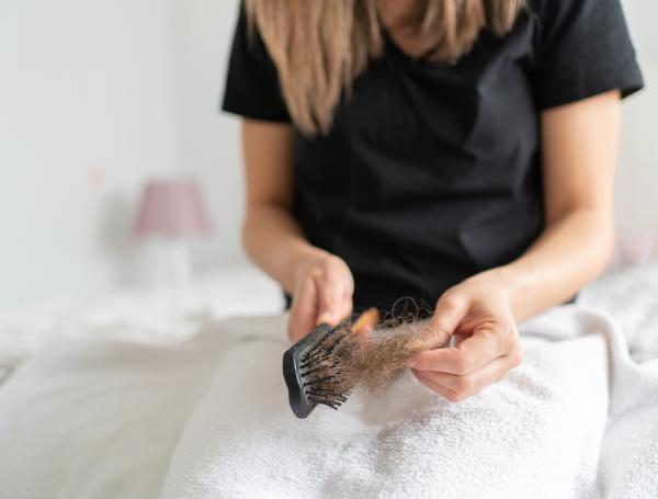 Alopecia