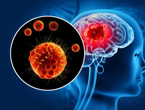 meningitis fúngica