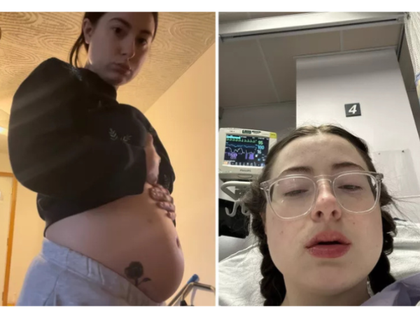 Endometriosis