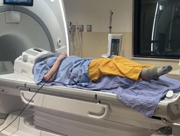 cáncer de piel