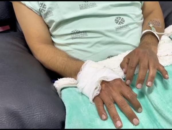 Persona herida por la explosión del cilindro de gas en Nariño, al parecer, por persona alicorada.