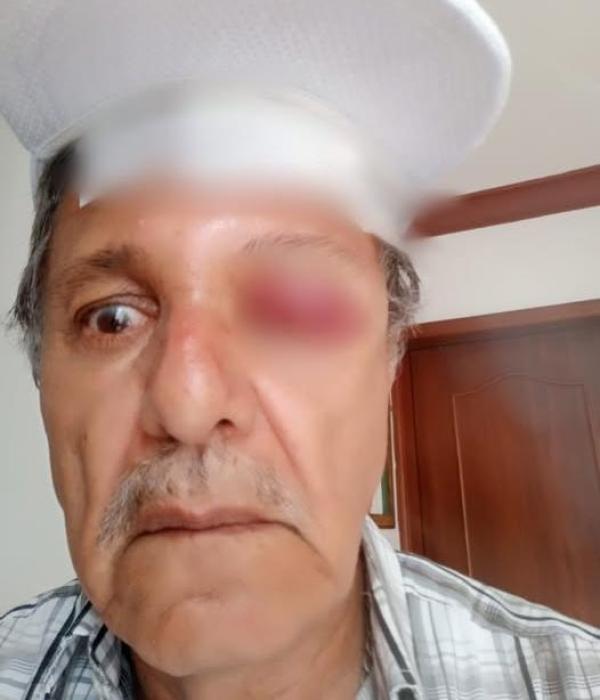Hugo Romero, camarógrafo, de 70 años, que resultó herido por golpes de un motociclista