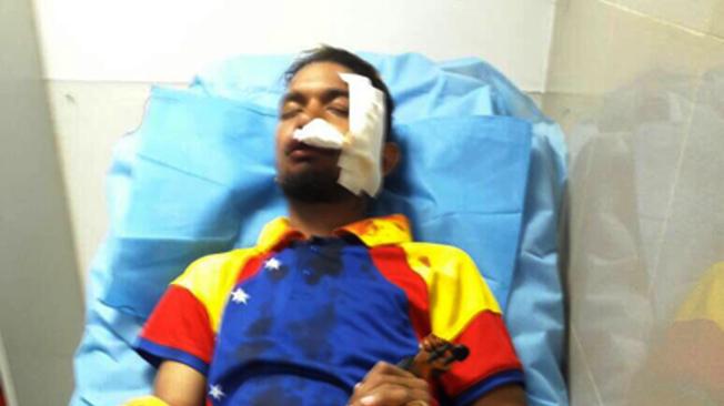 Wuilly Arteaga, violinista venezolano, que resultó herido hace unos días, pero que fue detenido en la huelga general del jueves.