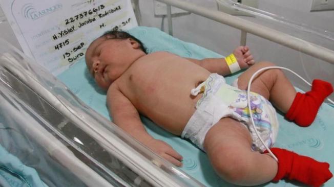 La mujer llegó a la clínica La Asunción de Barranquilla el lunes y, tras dos días de trabajo de parto, ingresó al quirófano a las 7:45 a. m del miércoles, y el nacimiento fue a las 8:06 a.m. de forma natural.