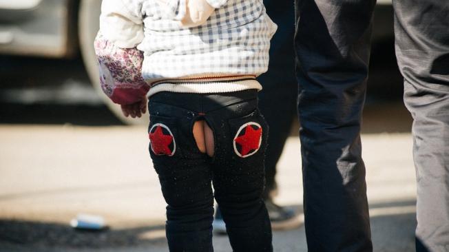 Algunos médicos se oponen al uso del pantalón abierto, debido a que consideran que no es higiénico. | Foto: Bruno Maestrini.