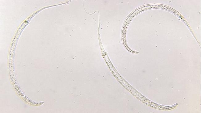 Los nematodos (o lombrices intestinales) son minúsculos pero son muy numerosos.