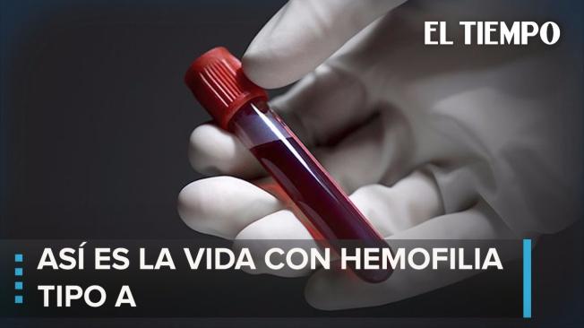 Hemofilia A, la forma más común de un mal poco común .