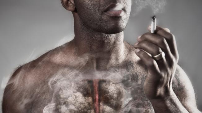 En el 80 por ciento de casos, el cáncer de pulmón se debe al tabaquismo.