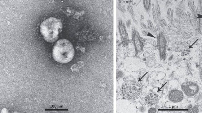 Imagen por microscopio del coronavirus 2019-nCoV. A la izquierda, aislado, con sus picos proteicos que le sirven para adherirse a las células. A la derecha, ya en el interior de las células.