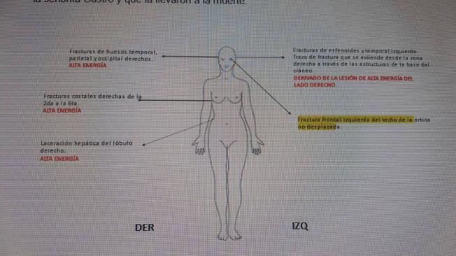 Esta imagen muestra una guía con las partes del cuerpo de Ana María Castro que sufrieron algún tipo de lesión durante la noche de su muerte.