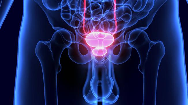 Es indispensable identificar a tiempo los síntomas e ir con su médico de confianza.