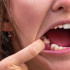 El dolor de muela se puede dar los las bacterias entre los dientes y las encías.
