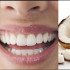 El aceite de coco y el bicarbonato se están utilizando para realizar una limpieza bucal natural.
