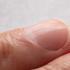 La experta en dermatología advirtió por la presencia de líneas verticales y oscuras en las uñas.