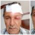 Hugo Romero, camarógrafo, de 70 años, que resultó herido por golpes de un motociclista