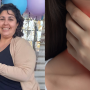 Mujer con tos y molestias en la garganta jamás imaginó que padecía cáncer