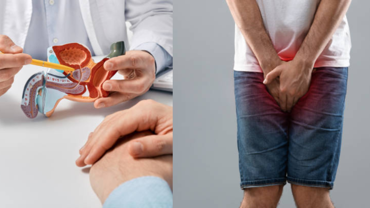 Estos son los dolores que, según expertos, se pueden tener si la próstata está inflamada