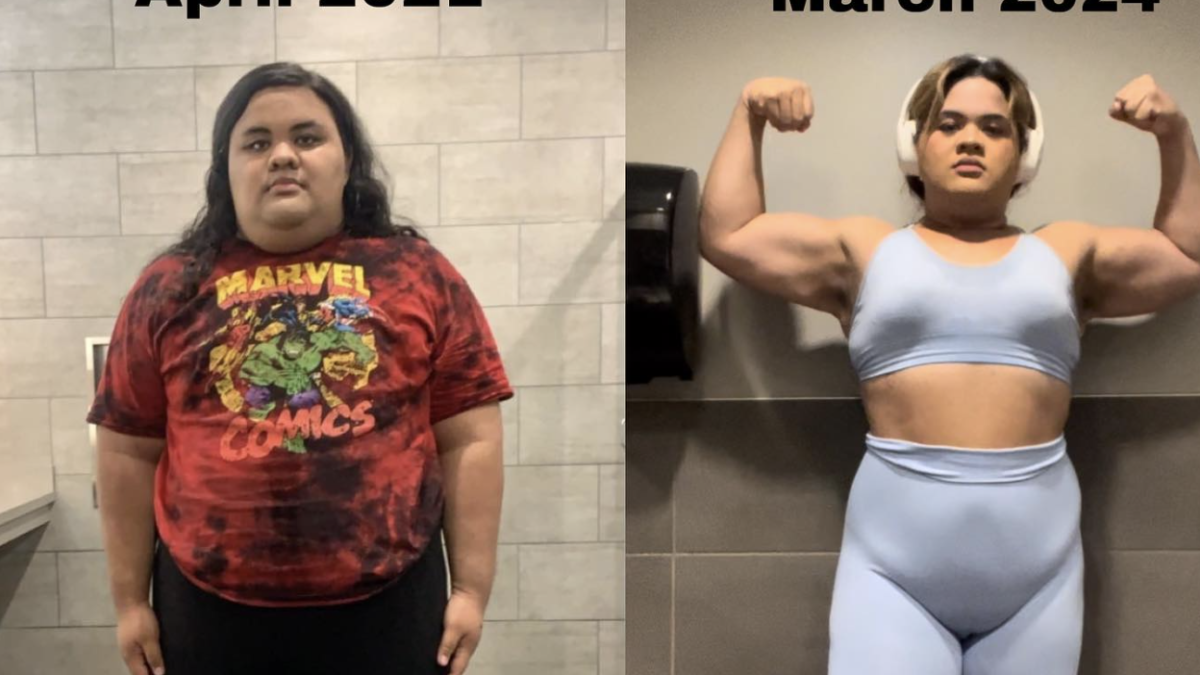 'A los 22 años pesaba 186 kilos, me sometí a una cirugía para bajar de peso y así estoy ahora'