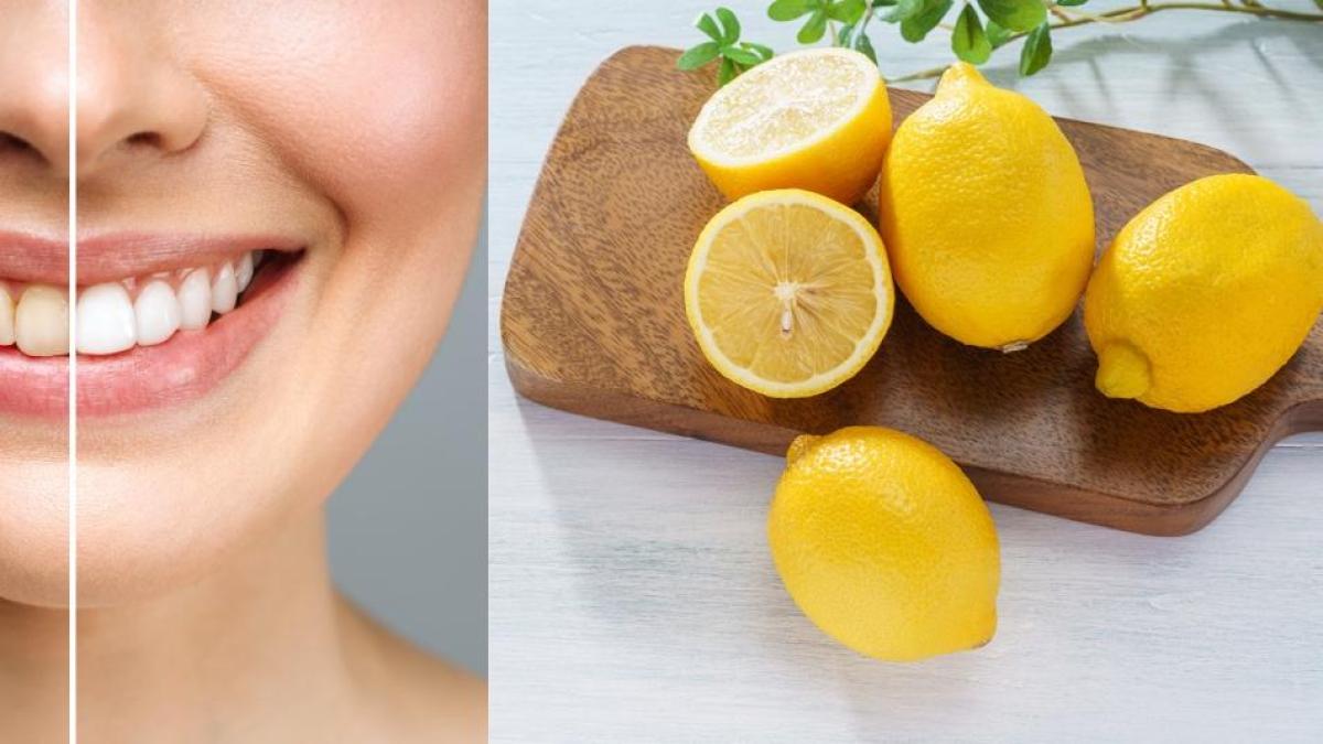 La fruta que eliminaría el sarro y los dientes amarillos en tiempo récord: enjuagues efectivos