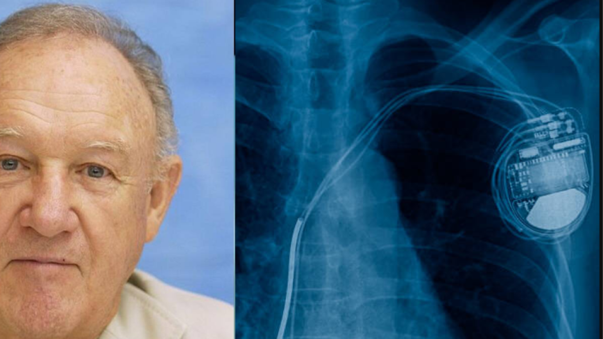 Autopsia final de Gene Hackman revela causas de muerte del actor: detalles sobre sus últimos días de vida